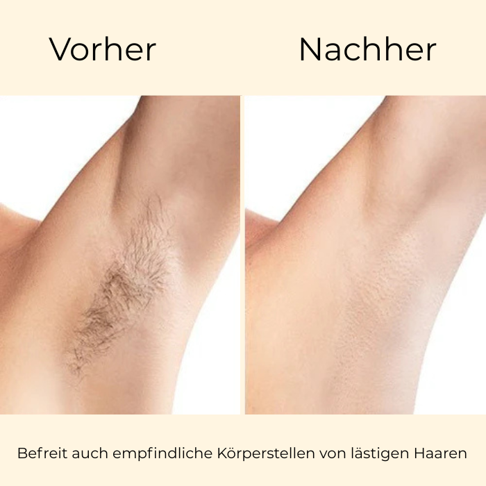 IHF AetherGlow™ IPL Pro