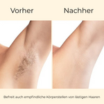 IHF AetherGlow™ IPL Pro